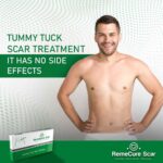 tummy-tuck-4